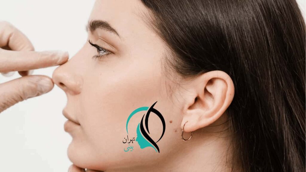 تزریق کورتون به بینی